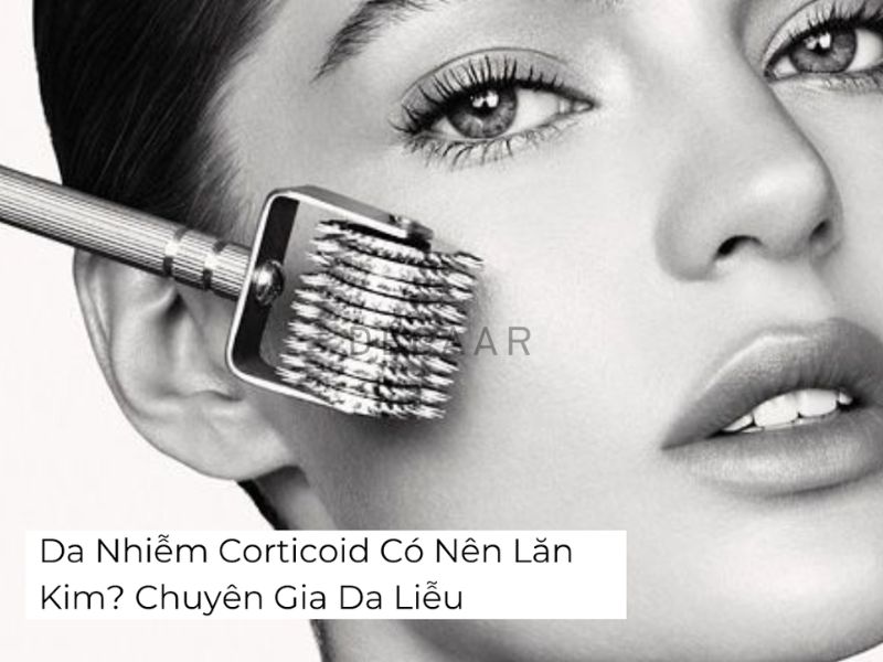 da nhiễm corticoid có nên lăn kim